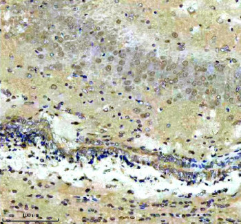 Anti-CXXC5 / CXXC-type zinc finger protein 5