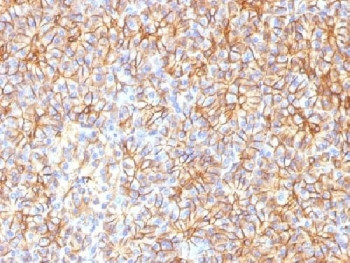 Anti-SPTBN2 / Spectrin beta III, clone SPTBN2/1584