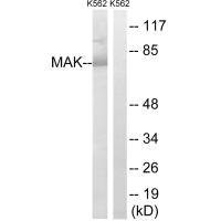 Anti-MAK (Ab-159)