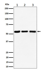 Anti-PRPF4 / Pre mRNA processing factor 4, clone 30P60