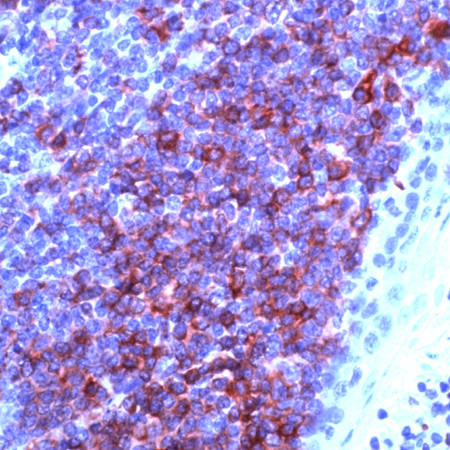 Anti-CD79a