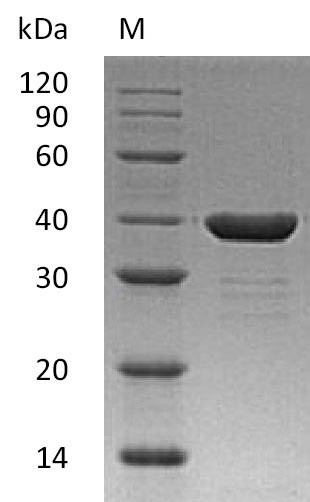 Carbonic anhydrase-related protein (CA8), partial (Active), human, recombinant