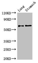 Anti-GAD2