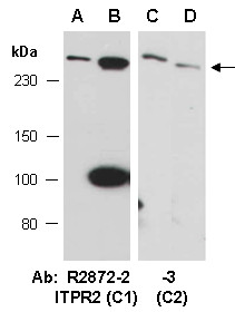 Anti-ITPR2 (C2)