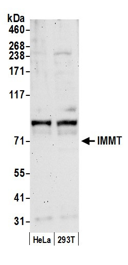 Anti-IMMT/Mitofilin