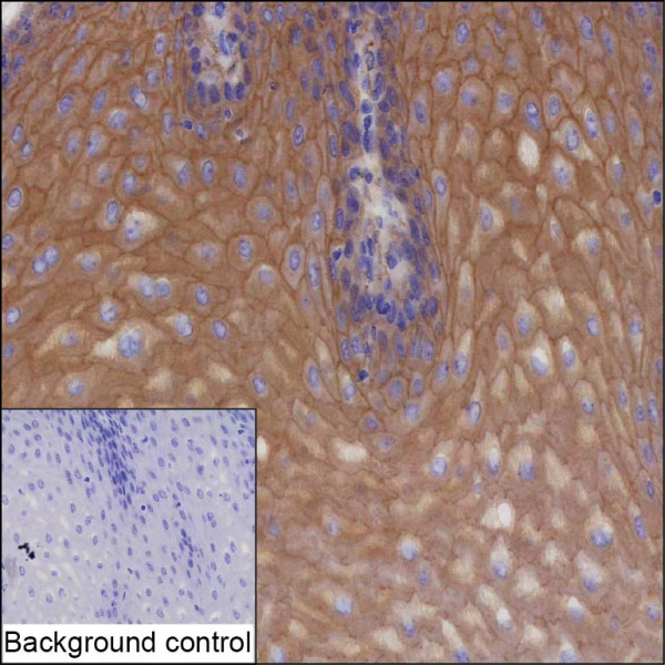 Anti-SPINT1