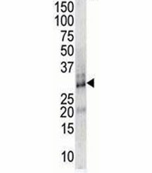 Anti-DSCR1