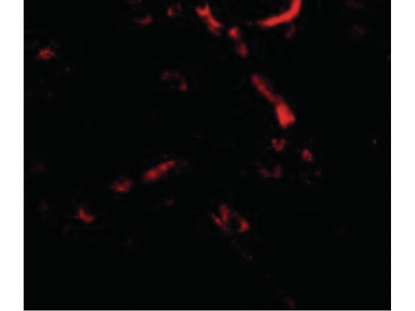 Anti-Syntaphilin