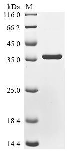 Protein mono-ADP-ribosyltransferase PARP16 (PARP16), partial, recombinant human