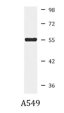 Anti-CPE / Carboxypeptidase E