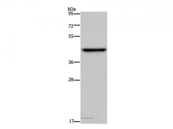 Anti-ENTPD5