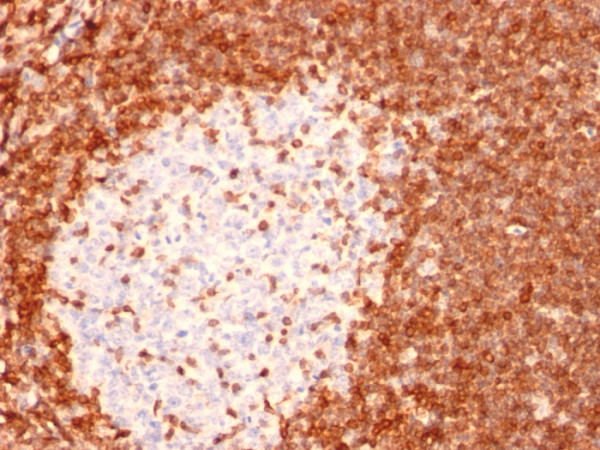 Anti-Bcl-2 (Apoptosis &amp; Follicular Lymphoma Marker), clone 8C8