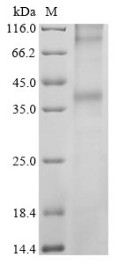 Long-wave-sensitive opsin 1 (OPN1LW), human, recombinant