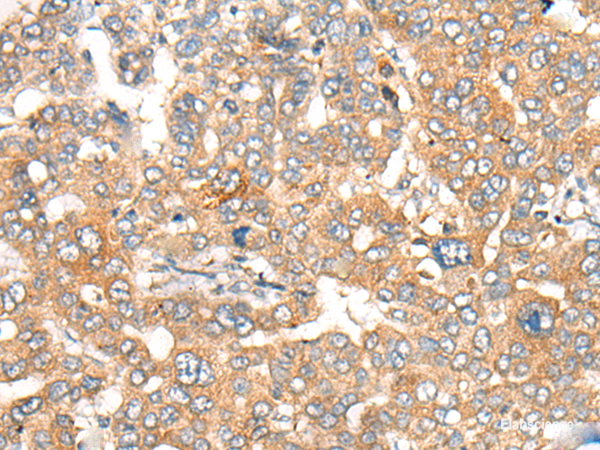 Anti-CASP4