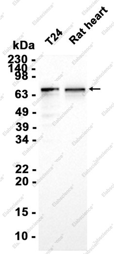 Anti-Recombinant YTHDF3, clone C123204