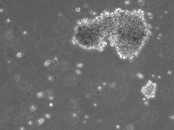 B-LCL-HROC130 Cells