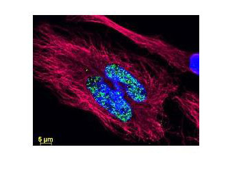 Anti-phospho-AKT (Ser473), DyLight(TM) 488 conjugated, clone 17B6.B11.A12.C3.G7.G12