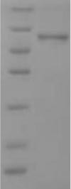 Small proline-rich protein 2B (SPRR2B), human, recombinant