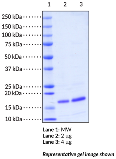 FABP5 (mouse recombinant)