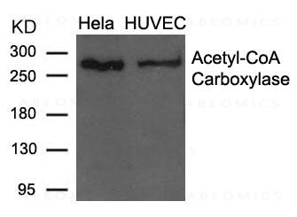 Anti-Acetyl-CoA Carboxylase (Ab-79)