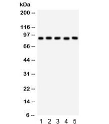 Anti-STAT5b