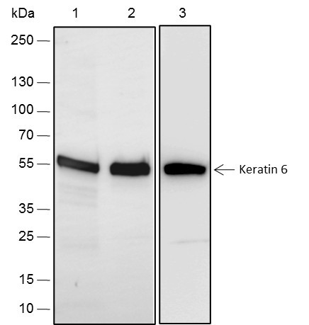 Anti-Recombinant Keratin 6, clone A281