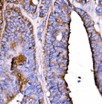Anti-HTR1B / 5HT1B