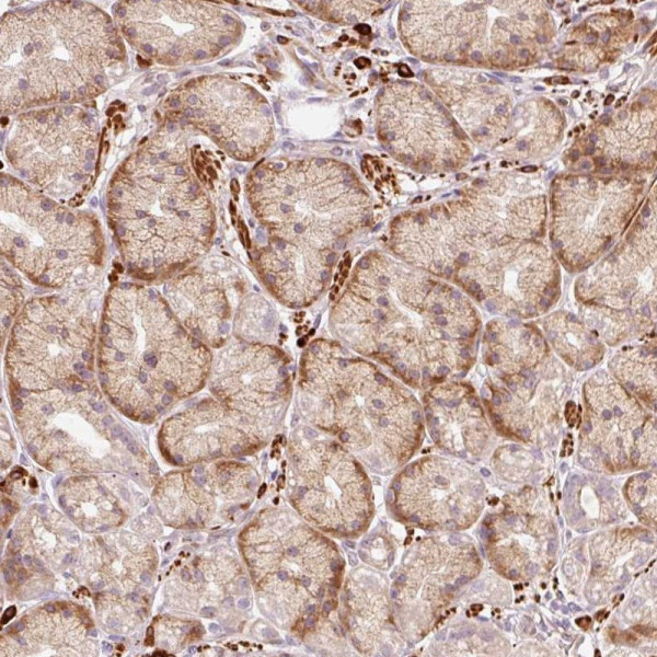Anti-RANBP2