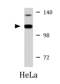Anti-alpha Actinin 4
