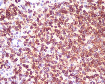 Anti-CD45 / PTPRC, clone CBI-16