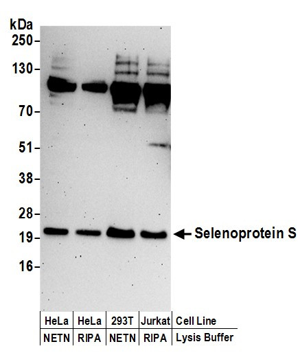 Anti-Selenoprotein S