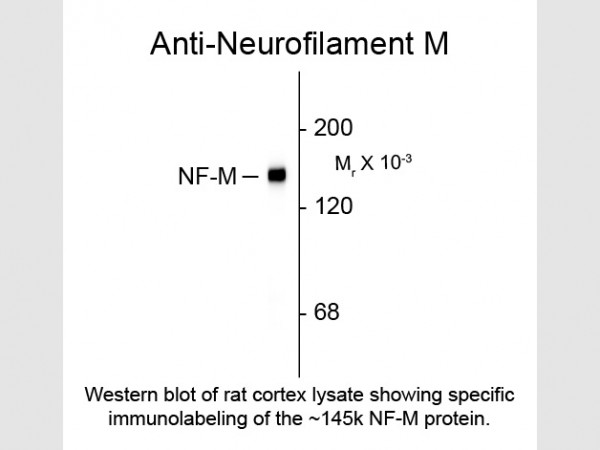 Anti-Neurofilament M, clone 3H11