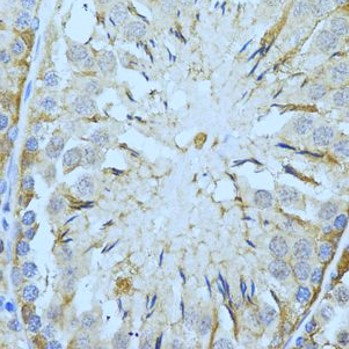 Anti-Tropomyosin 2