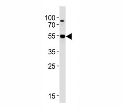 Anti-AKT3