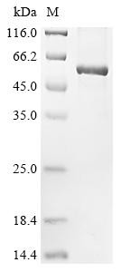 E3 ubiquitin-protein ligase ZFP91 (ZFP91), partial, human, recombinant