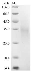 Low-density lipoprotein receptor-related protein 2 (LRP2), partial, human, recombinant