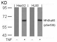 Anti-phospho-NFkB-p65 (Ser536)
