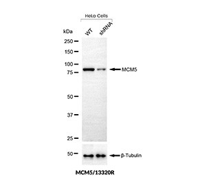 Anti-MCM5 / Replication licensing factor MCM5, clone MCM5/13320R