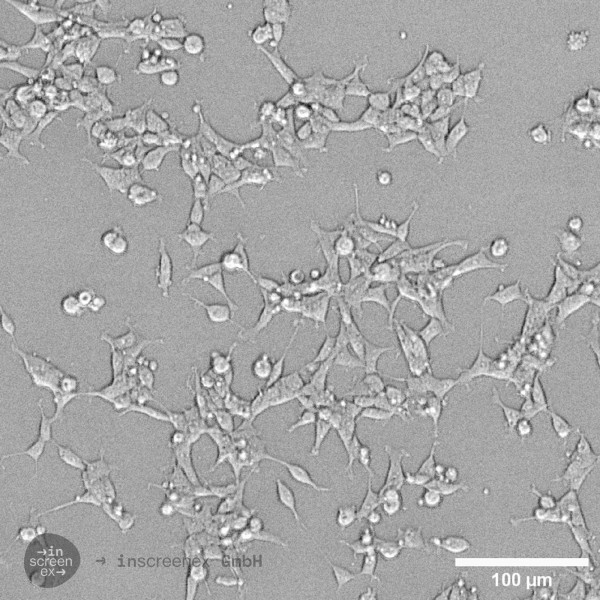HEK293-CXCR4 Cells