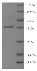 Intraflagellar transport protein 27 homolog (IFT27), human, recombinant