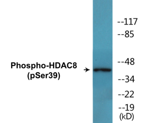 HDAC8 (Phospho-Ser39) Colorimetric Cell-Based ELISA Kit