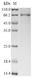 Putative accessory processing protein (hmwC), partial, Yersinia pestis, recombinant