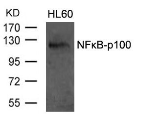 Anti-NFkB p100/p52