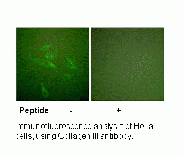 Anti-Collagen III