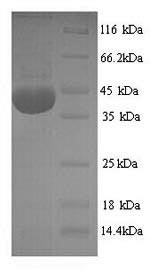 NADPH oxidase 4 (Nox4), partial, rat, recombinant