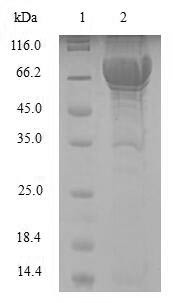 Phenylalanine-4-hydroxylase (PAH), human, recombinant