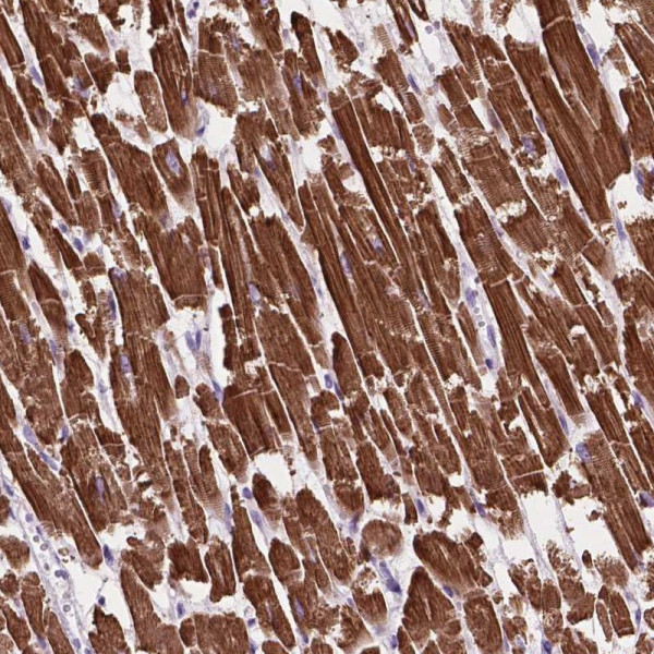 Anti-MBTPS1