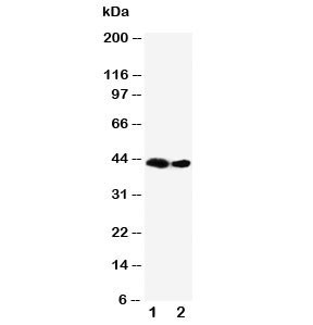 Anti-Flt3 ligand
