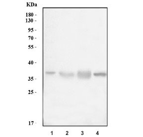 Anti-Cathepsin L / CTSL