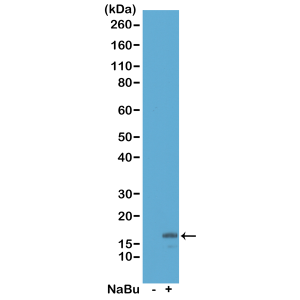 Anti-Acetyl-Histone H3 (Lys18), Rabbit Monoclonal (RM166)
